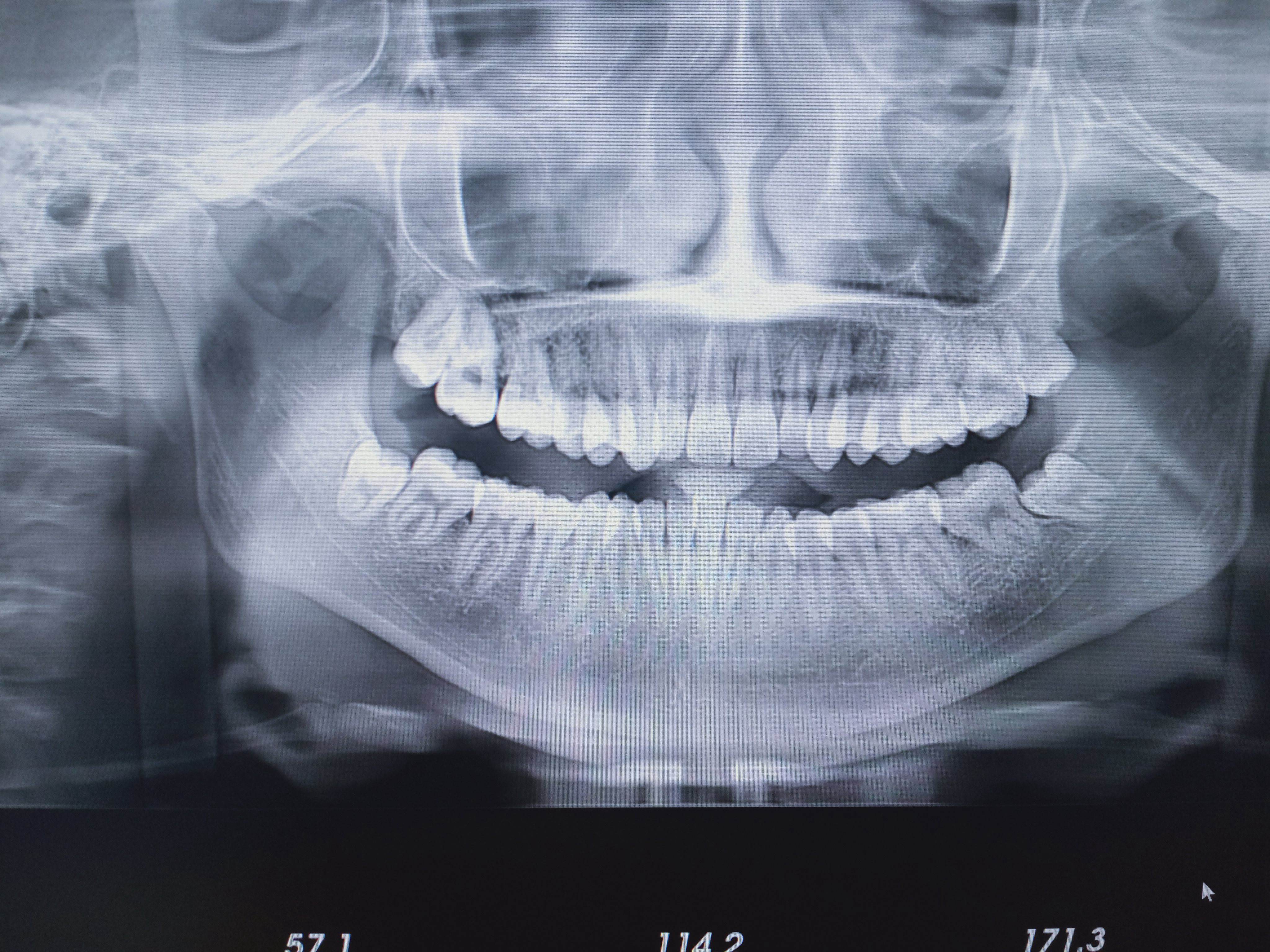 口腔ct怎么看我院口腔科引进CBCT，为目前防城港市检查视野最大的口腔CT检查设备_https://www.jmylbn.com_新闻资讯_第3张