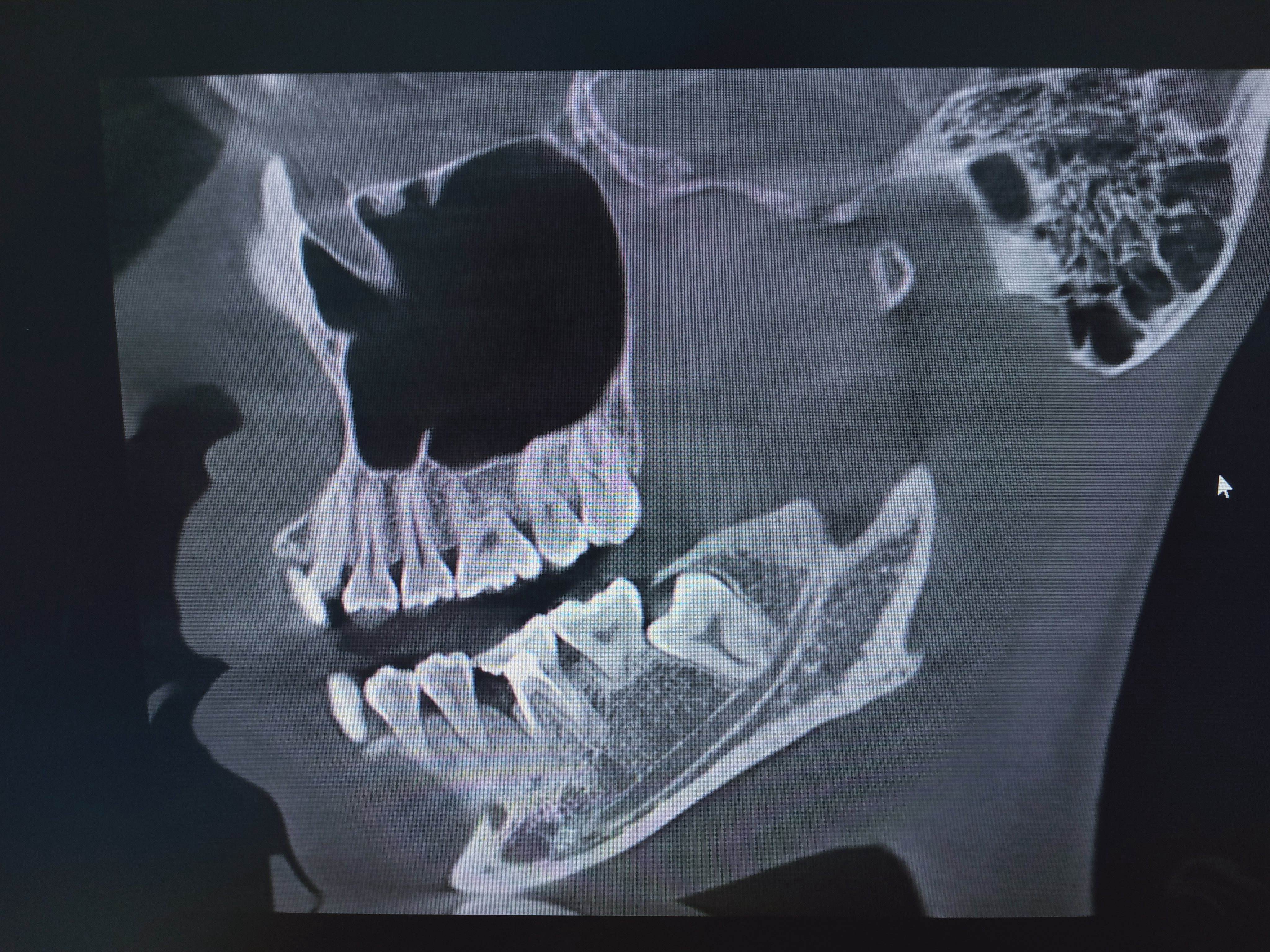 口腔ct怎么看我院口腔科引进CBCT，为目前防城港市检查视野最大的口腔CT检查设备_https://www.jmylbn.com_新闻资讯_第5张