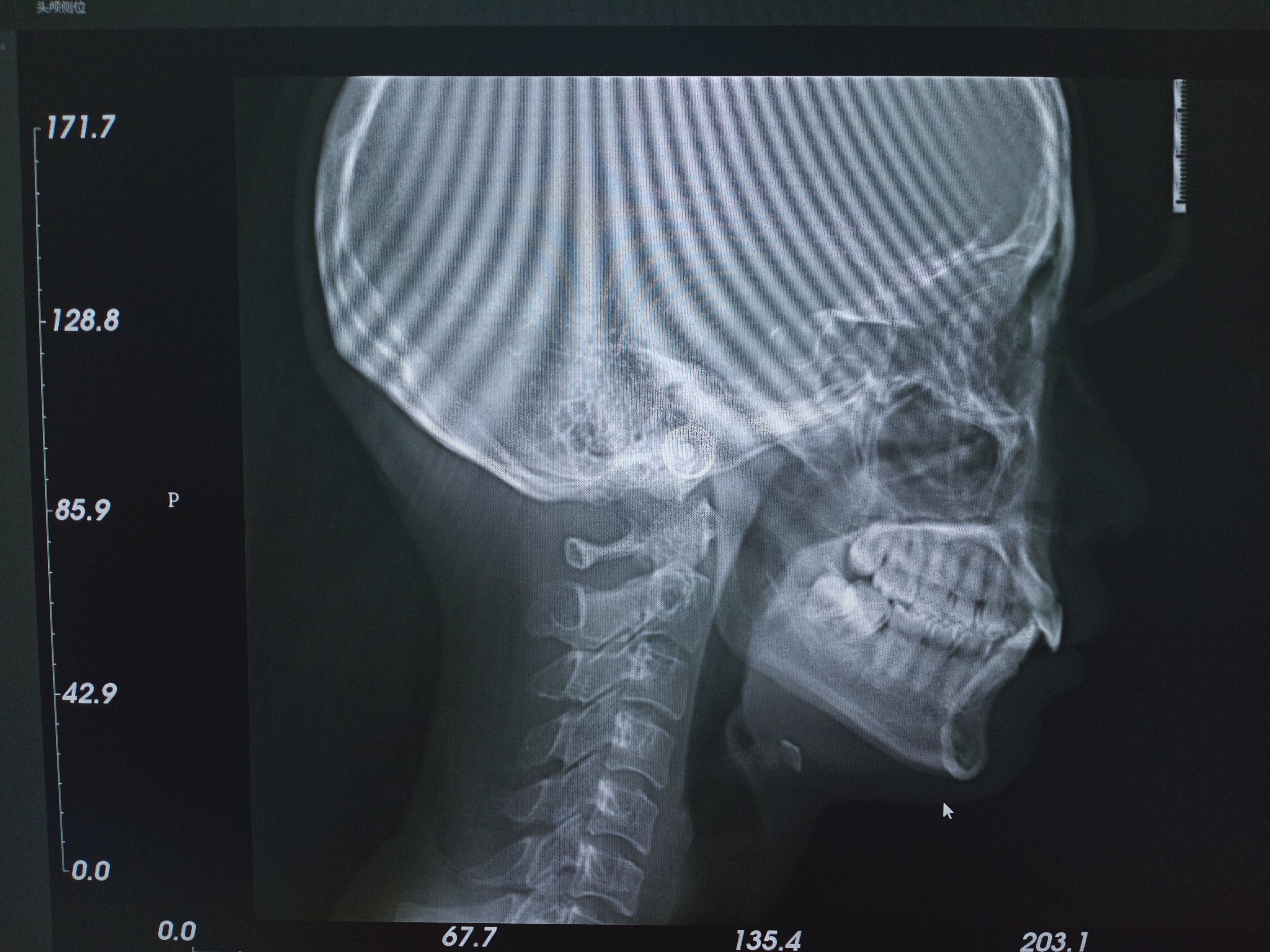 口腔ct怎么看我院口腔科引进CBCT，为目前防城港市检查视野最大的口腔CT检查设备_https://www.jmylbn.com_新闻资讯_第6张