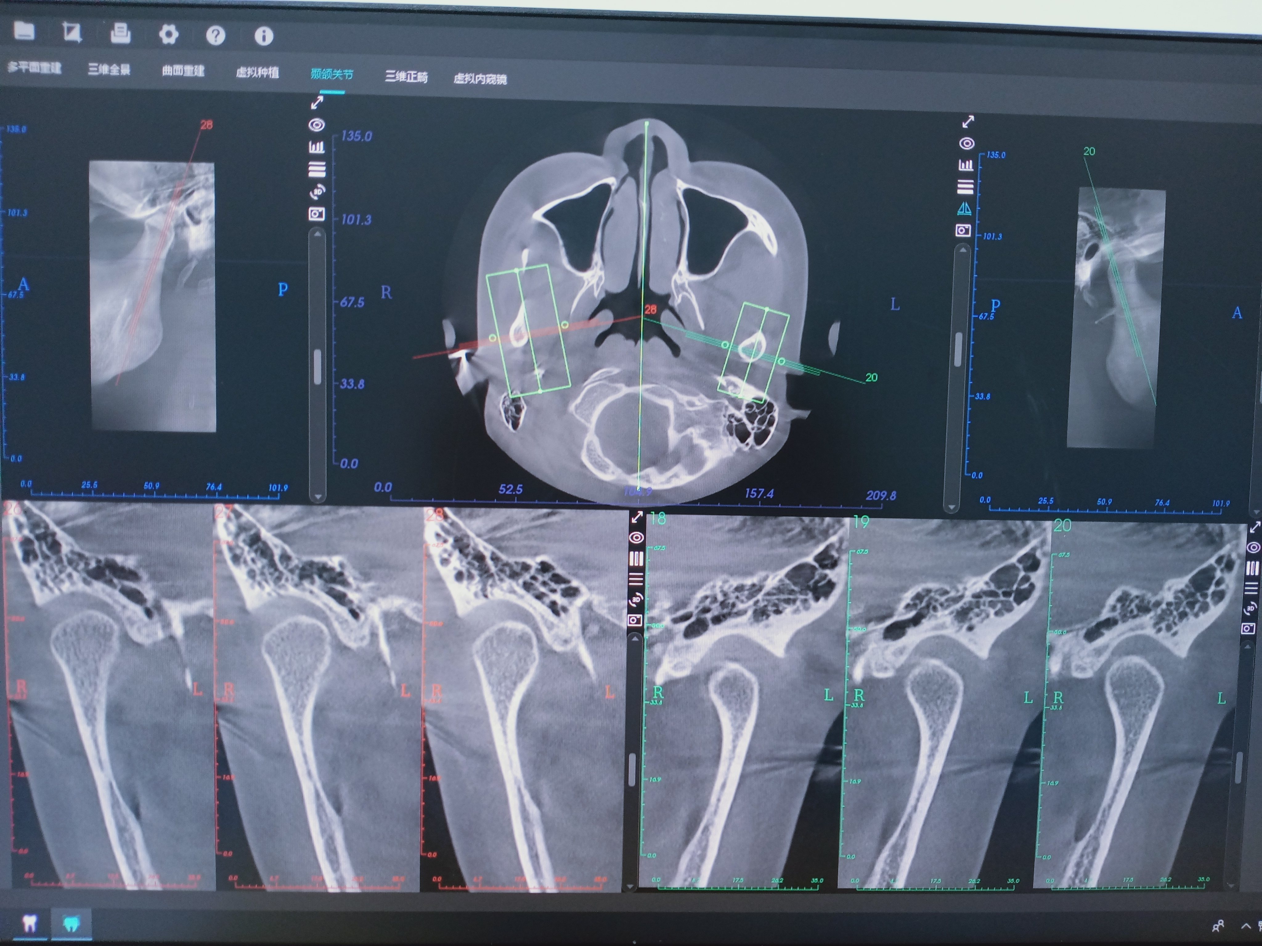 口腔ct怎么看我院口腔科引进CBCT，为目前防城港市检查视野最大的口腔CT检查设备_https://www.jmylbn.com_新闻资讯_第7张